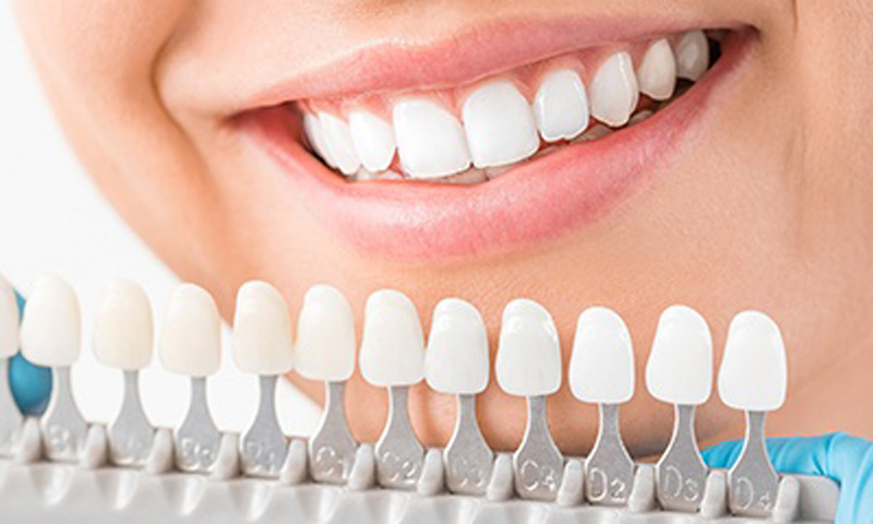 Philips Zoom teeth whitening